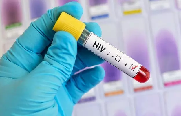 इंजेक्शन से नशा करने वाले 42 लोग HIV संक्रमित, वाराणसी के इस अस्पताल में चल रहा इलाज